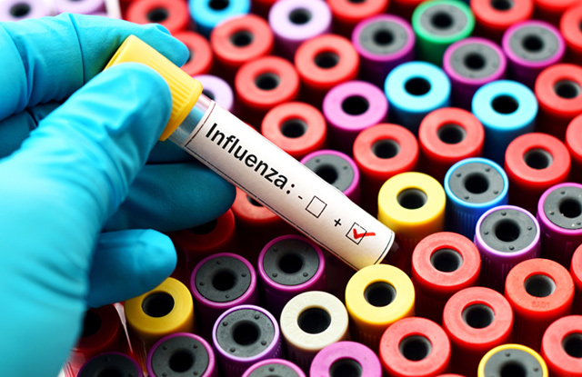 Doctor-Holding-Positive-Sample-of-Influenza-Virus