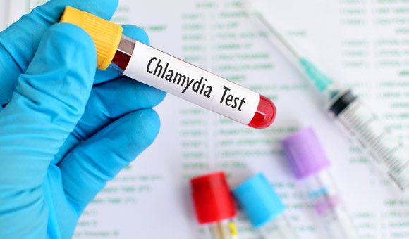 Chlamydia Test